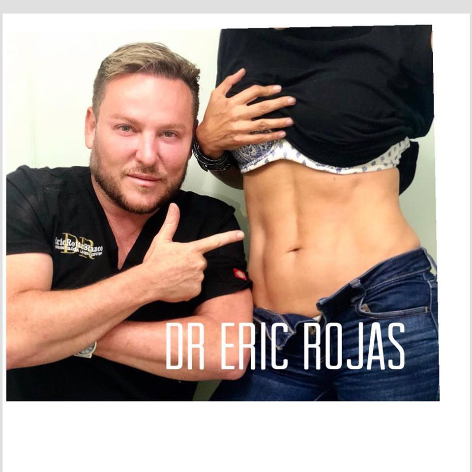 Slim Láser DR ERIC ROJAS CREA UN ABDOMEN QUE PUEDES LUCIR EN CUALQUIER LUGAR