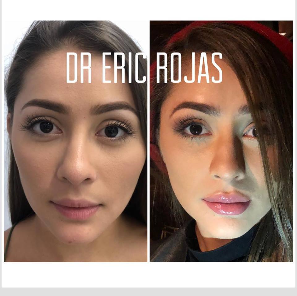 LABIOS INCREÍBLES