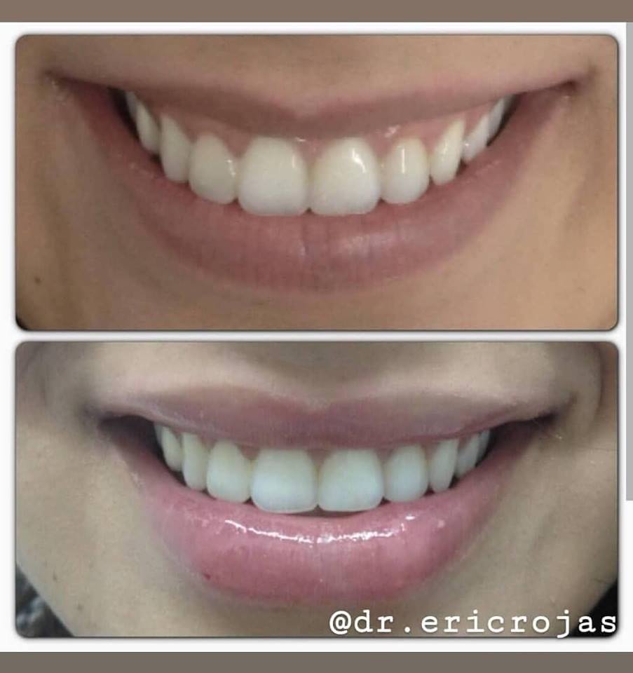 Labios más atractivos