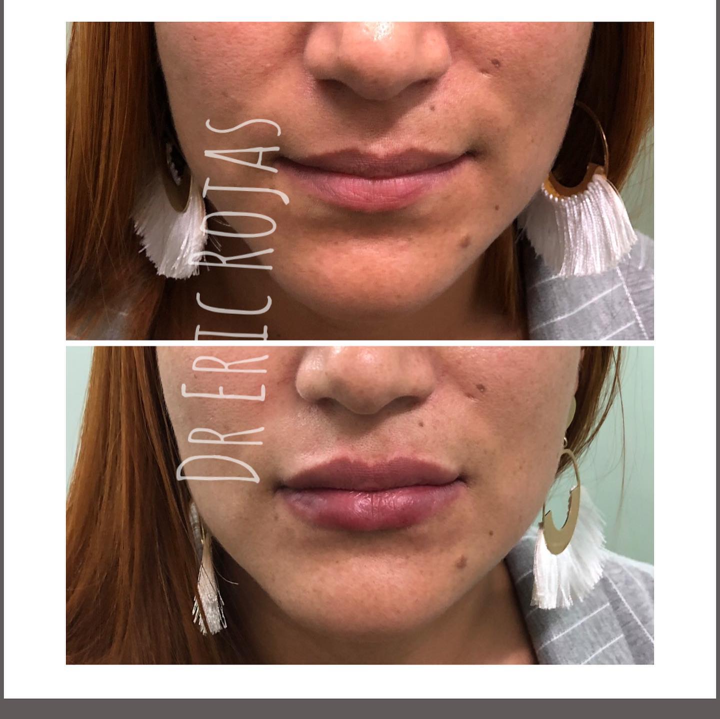 Tus Labios pueden ser más atractivos en solo minutos..