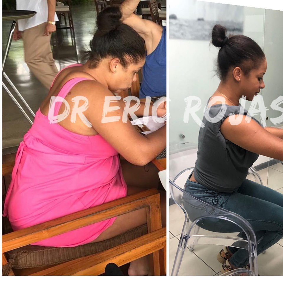 40 kilos en dos meses …