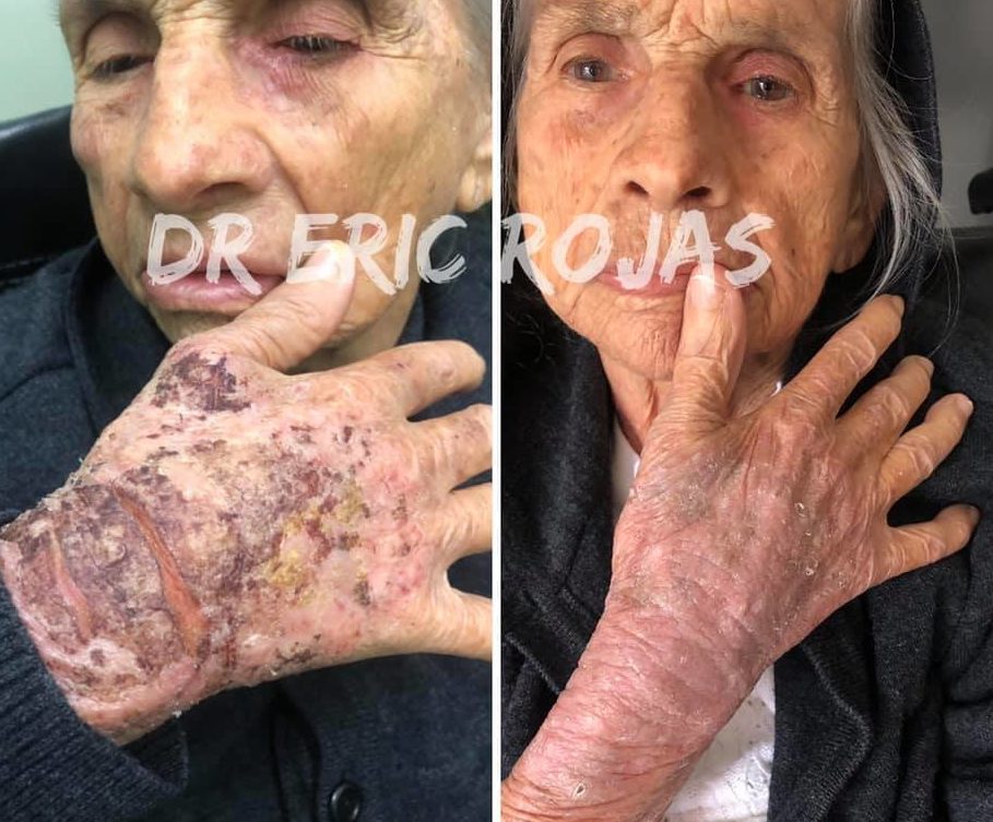 Mejoramos tus lesiones