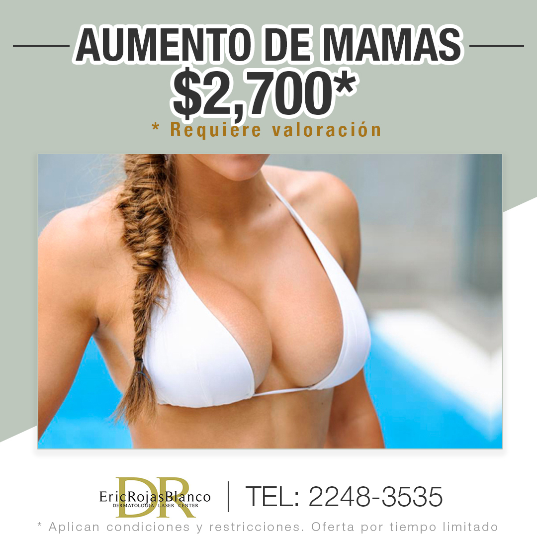 AUMENTO DE MAMAS