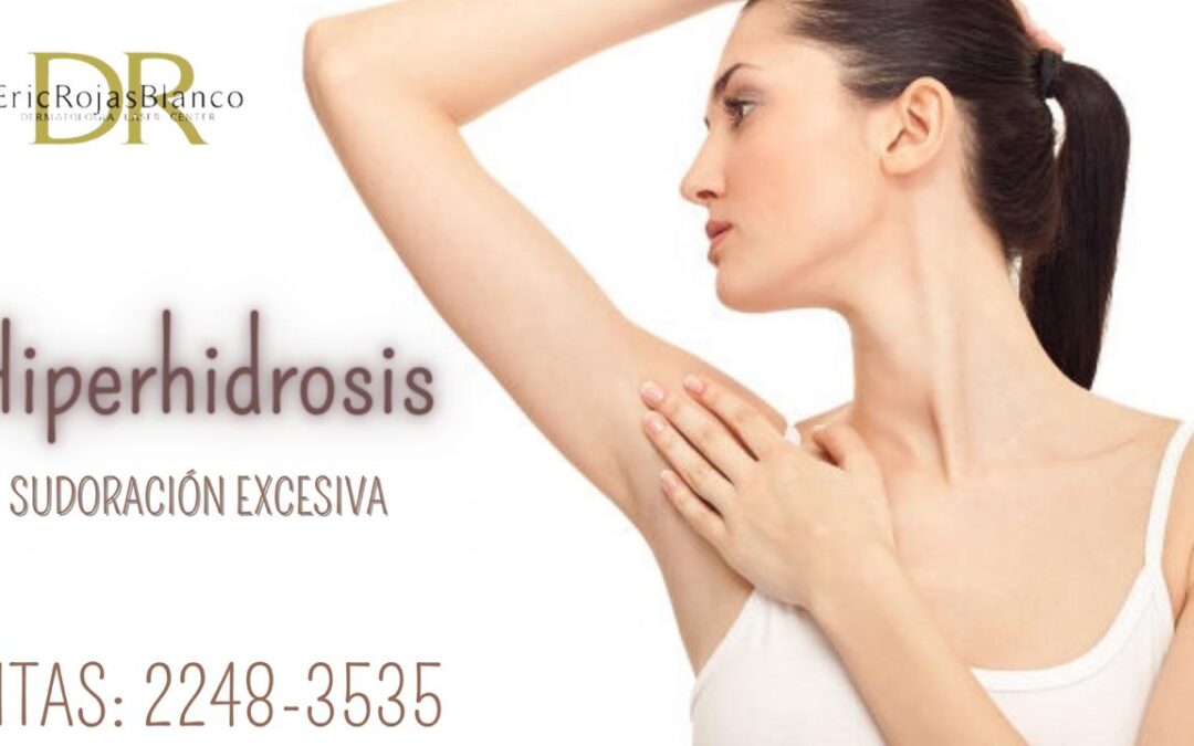 Hiperhidrosis(Exceso de sudoración).