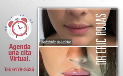 Labios definidos 