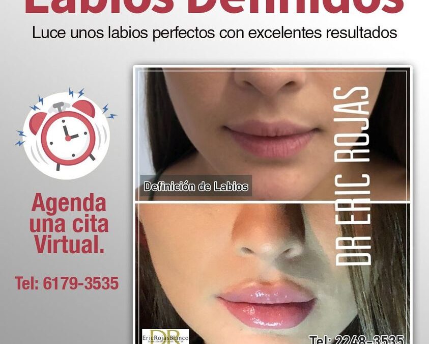 Labios definidos 
