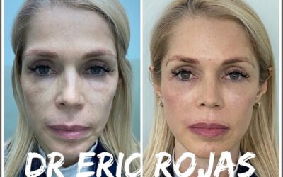 REJUVENECE CON EL DR ÉRIC ROJAS