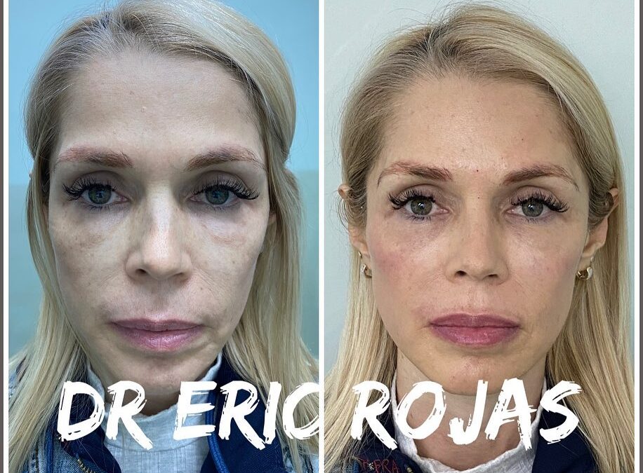 REJUVENECE CON EL DR ÉRIC ROJAS