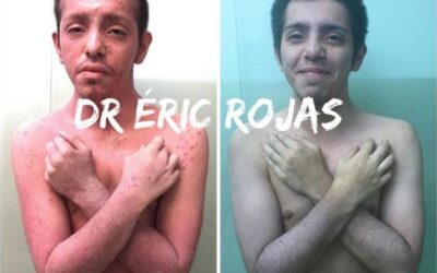 Tenemos el tratamiento que necesitas