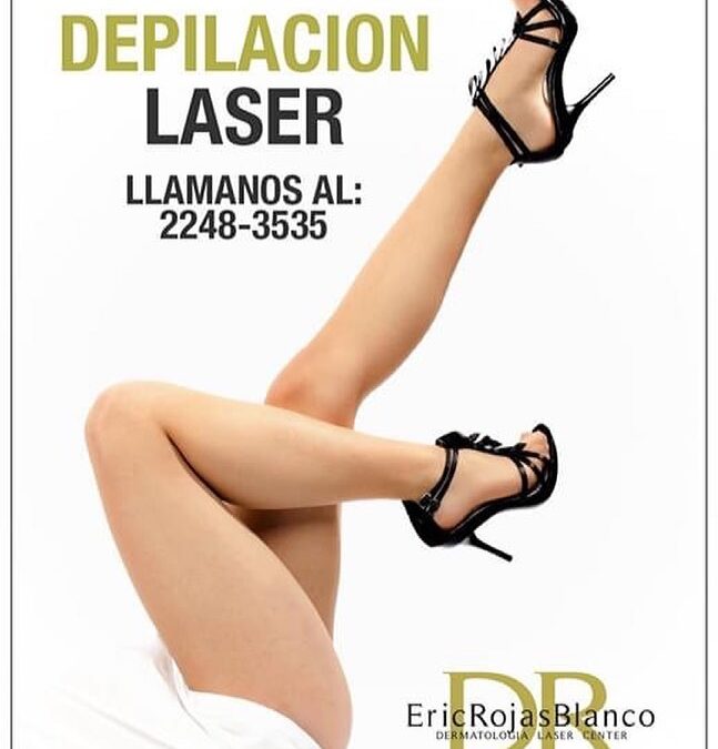 Depilación láser