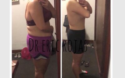 Mesoterapia