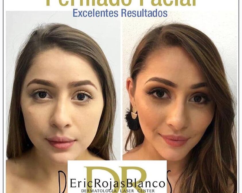 Perfilado Facial