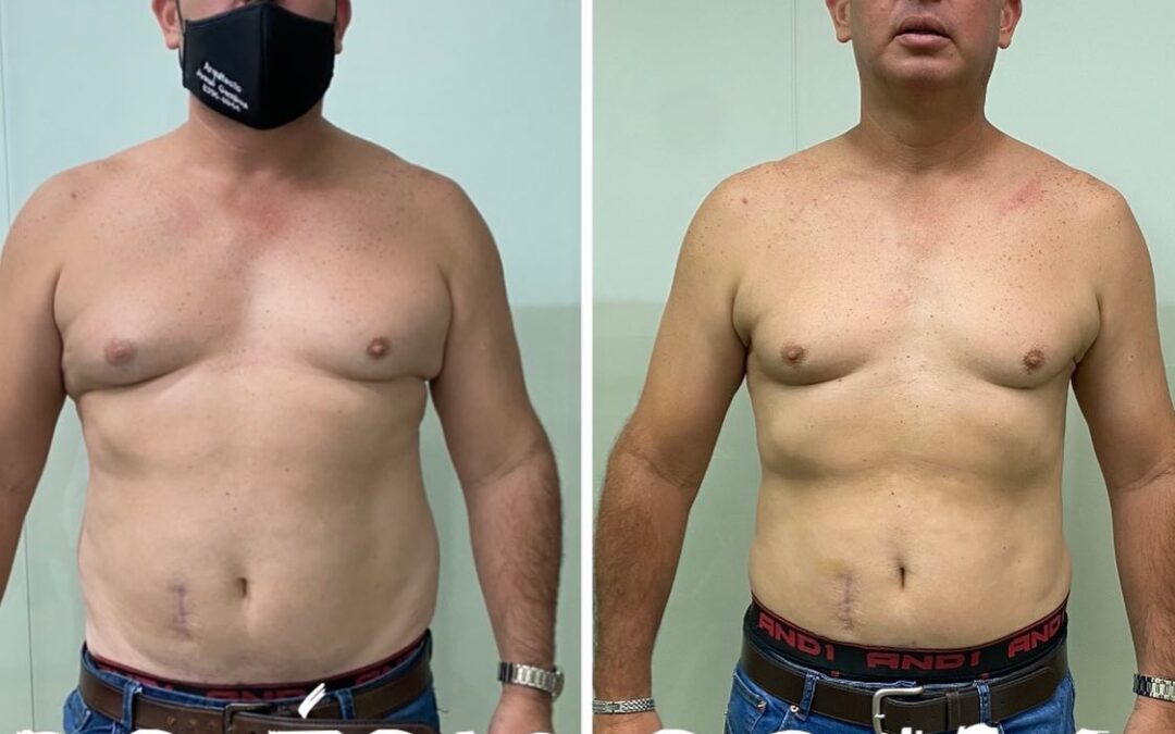 DR ERIC ROJAS PUEDES MEJORAR TU ASPECTO