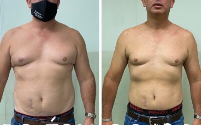 DR ERIC ROJAS PUEDES MEJORAR TU ASPECTO