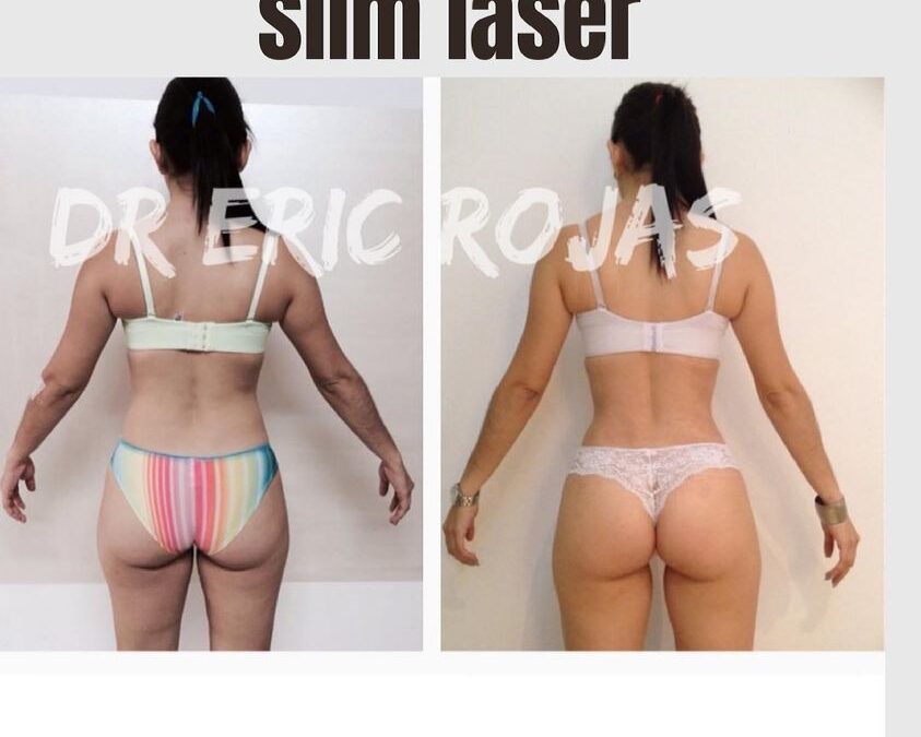 Slim laser