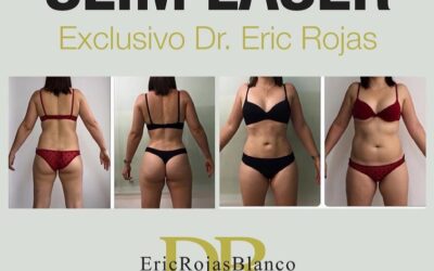 Slim laser es un procedimiento exclusivo del Dr Eric Rojas.