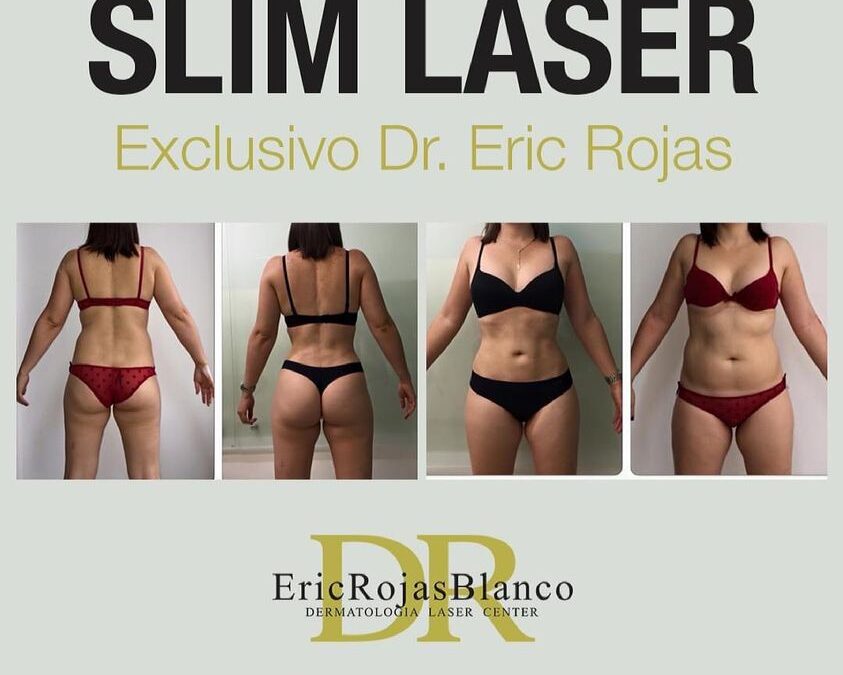 Slim laser es un procedimiento exclusivo del Dr Eric Rojas.