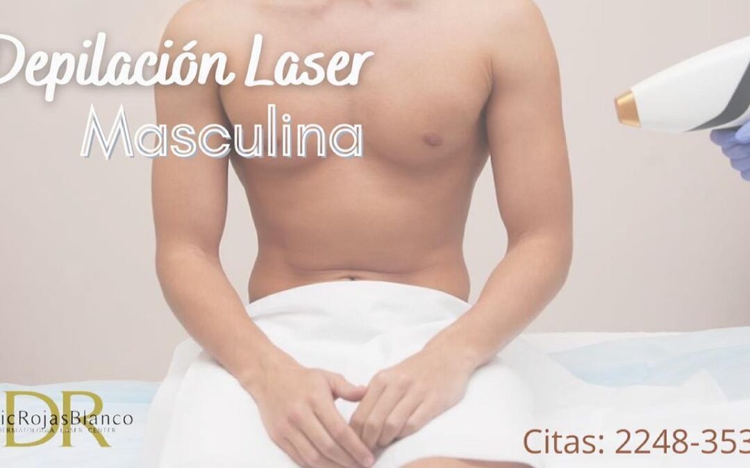 Depilación láser masculina
