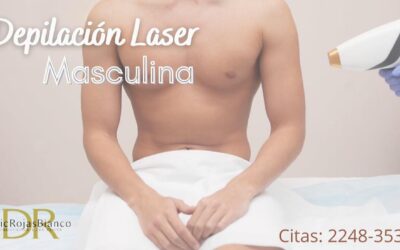 Depilación láser masculina