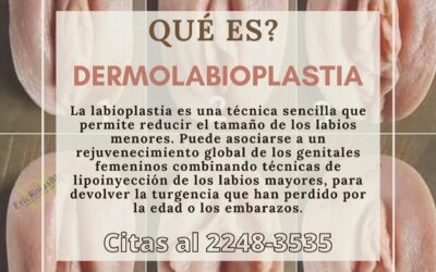 ¿Qué es la Dermolabioplastía?