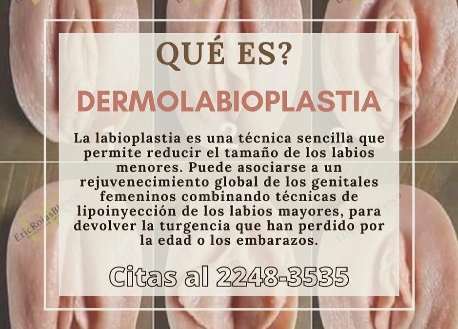 ¿Qué es la Dermolabioplastía?