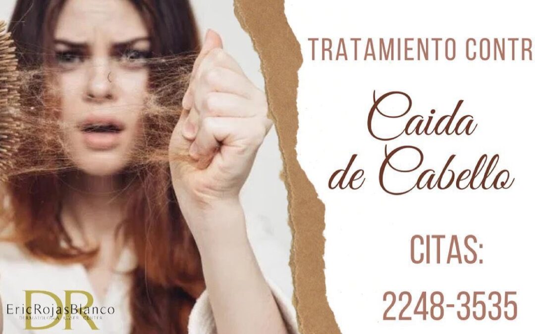 Se te cae el cabello ?