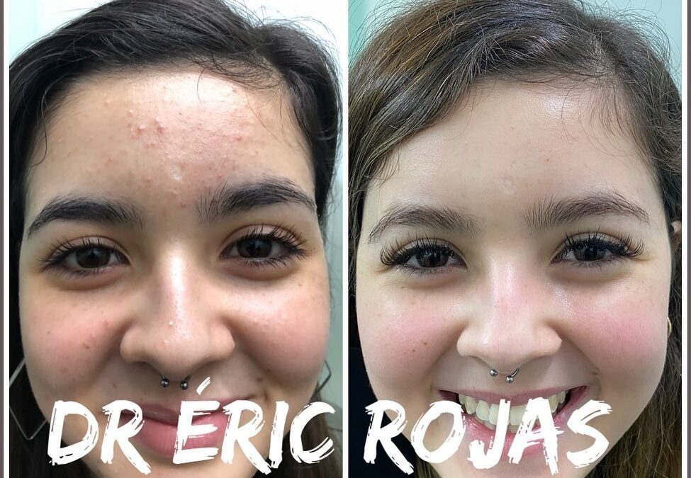Cara de MUÑECA