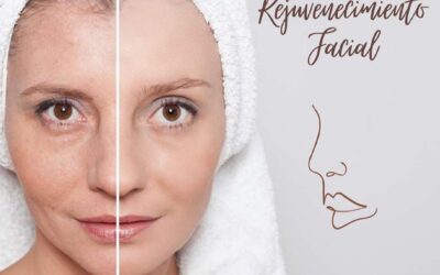 Rejuvenecimiento Facial