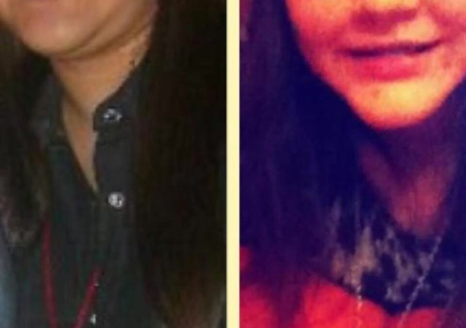 Con la eliminación de la papada