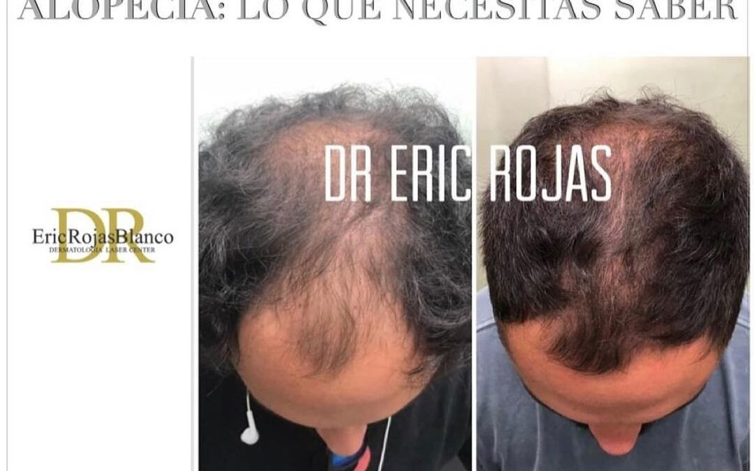 Sabias que el virus del COVID -19