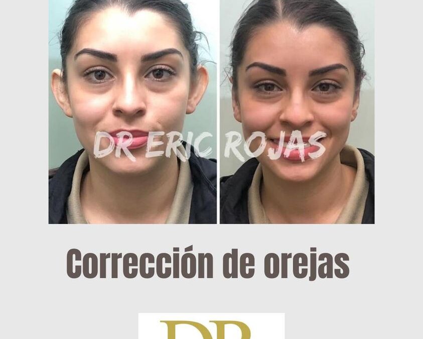 CONSULTA 2248-3535