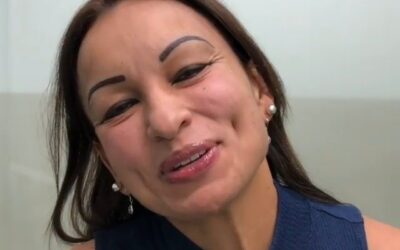 Tratamiento contra manchas en la cara