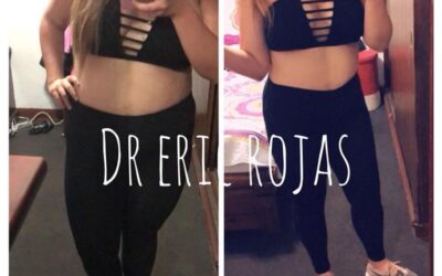 Menos kilos, más salud…