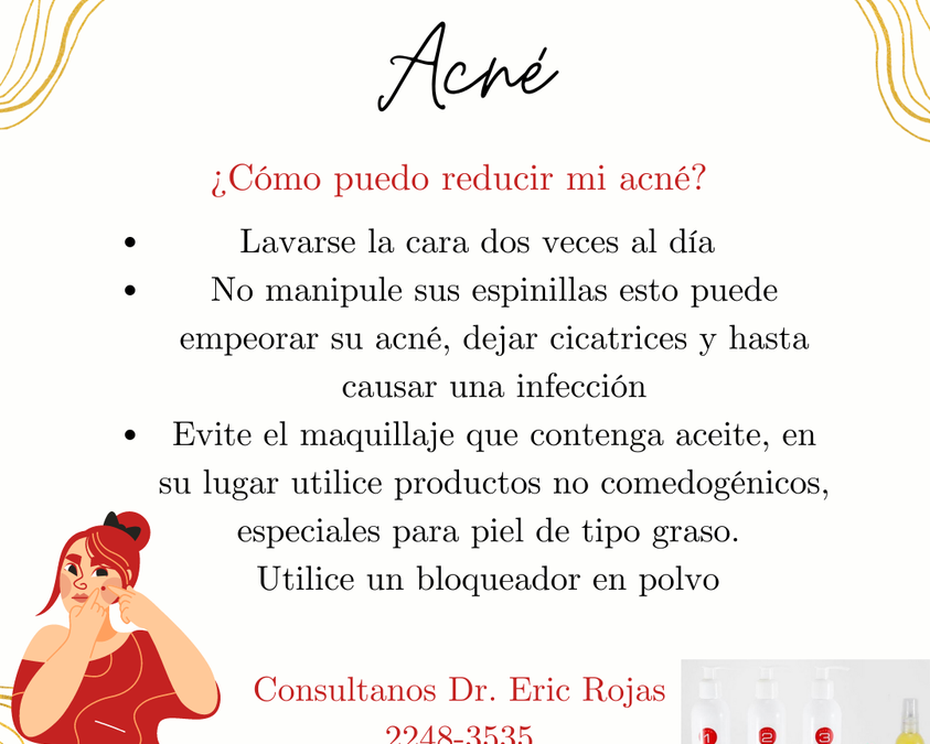 Pasos para usar el kit antiacné