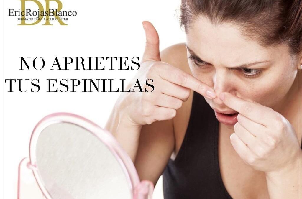 Espinillas