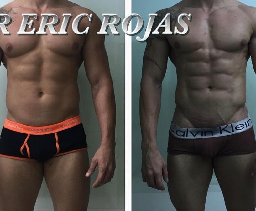 Slim laser en hombres, realmente increíble cambiamos vidas.