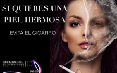 Fumar reduce la elasticidad natural de la piel