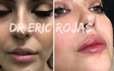Definición de labios