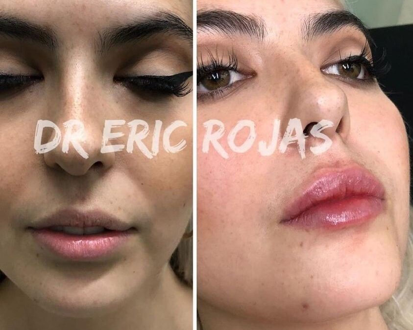 Definición de labios