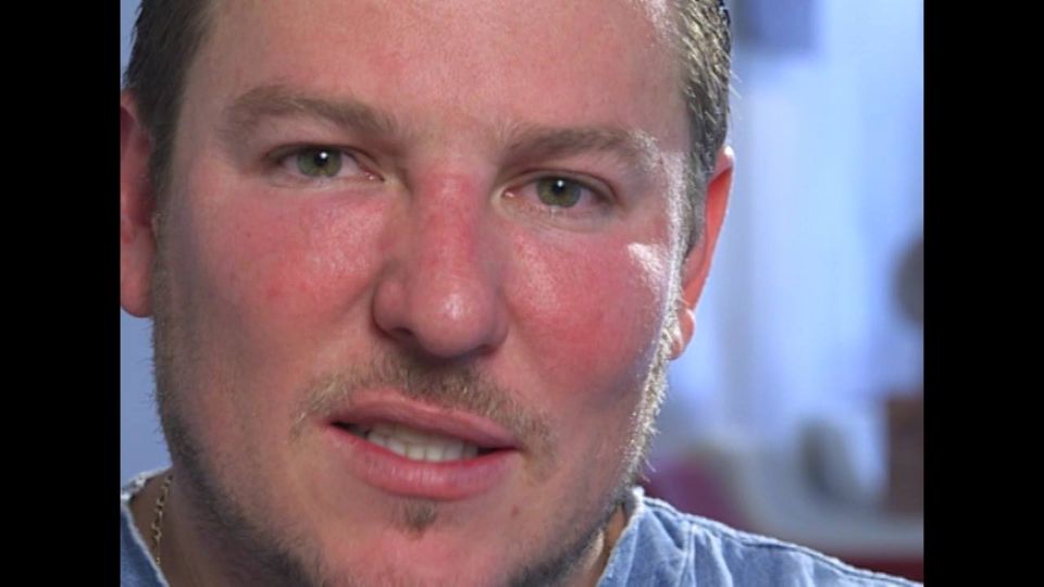 Ya no tiene porqué esconderse o avergonzarse por las arrugas en su rostro y aspecto cansado
