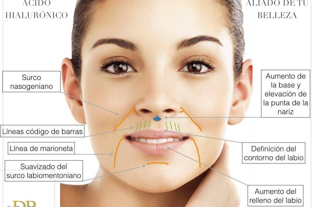 El acido hialurónico