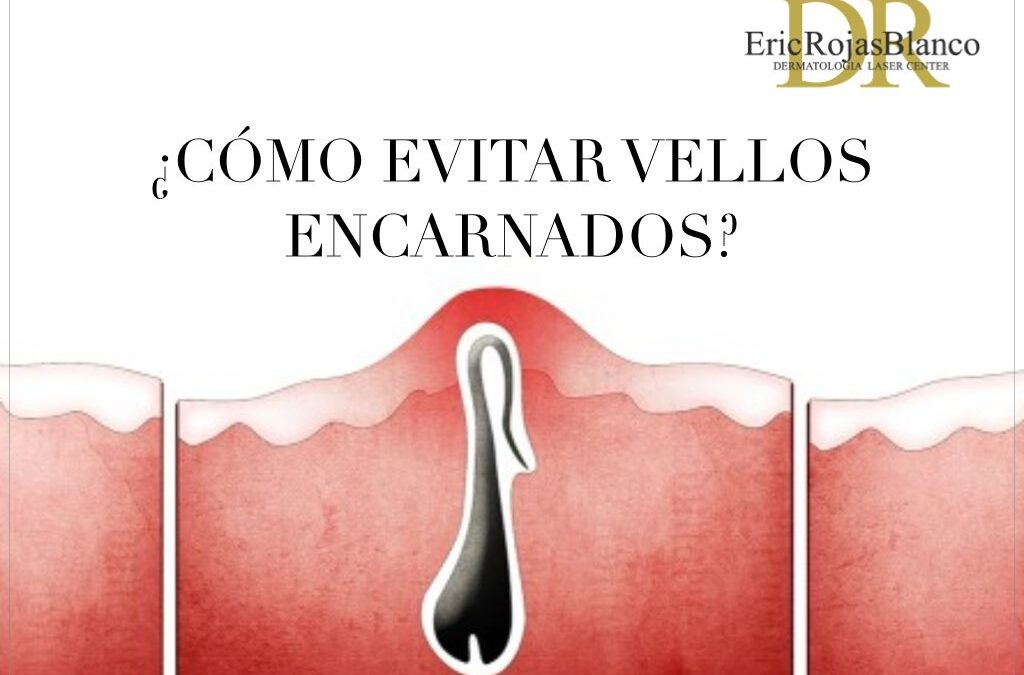 Los vellos encarnados