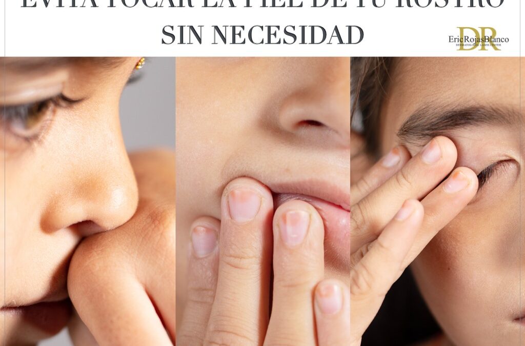 Las bacterias e impurezas sobre nuestras manos pueden provocar la aparición de granos y acné .