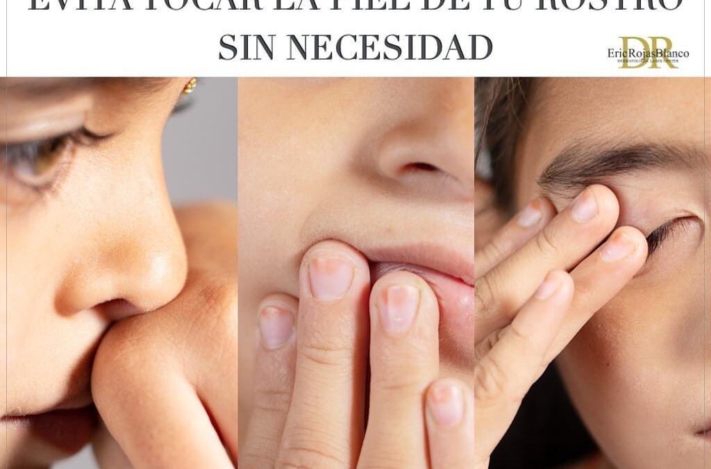 Las bacterias e impurezas sobre nuestras manos pueden provocar la aparición de granos y acné .