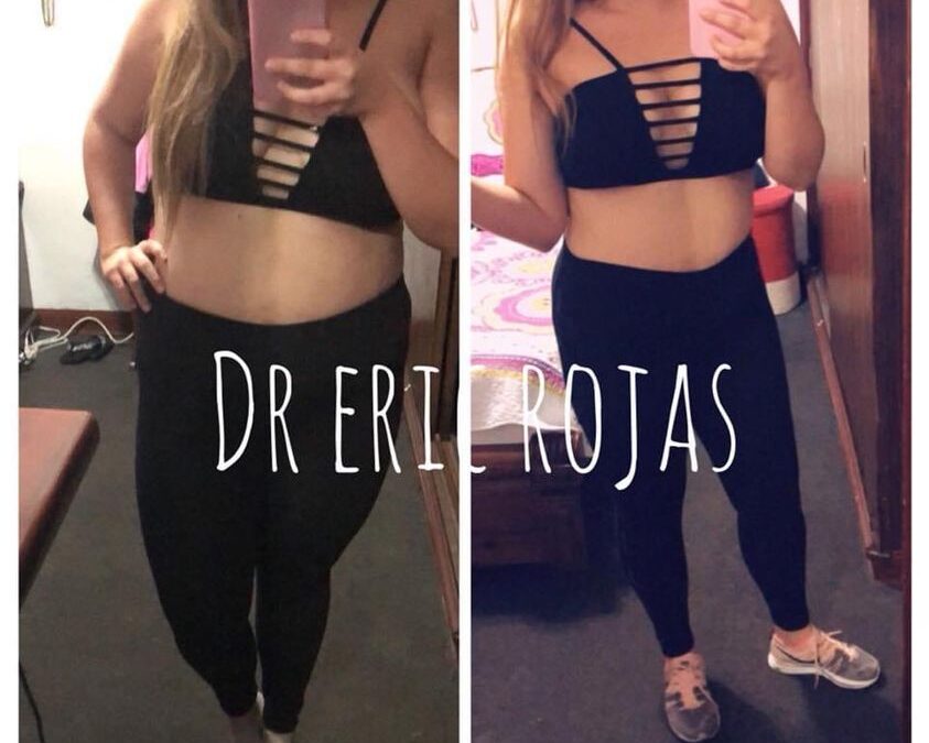 Menos kilos, más salud…
