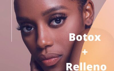 Promoción de Botox + relleno en $500