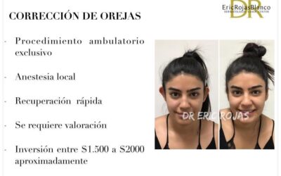 Corrección de orejas