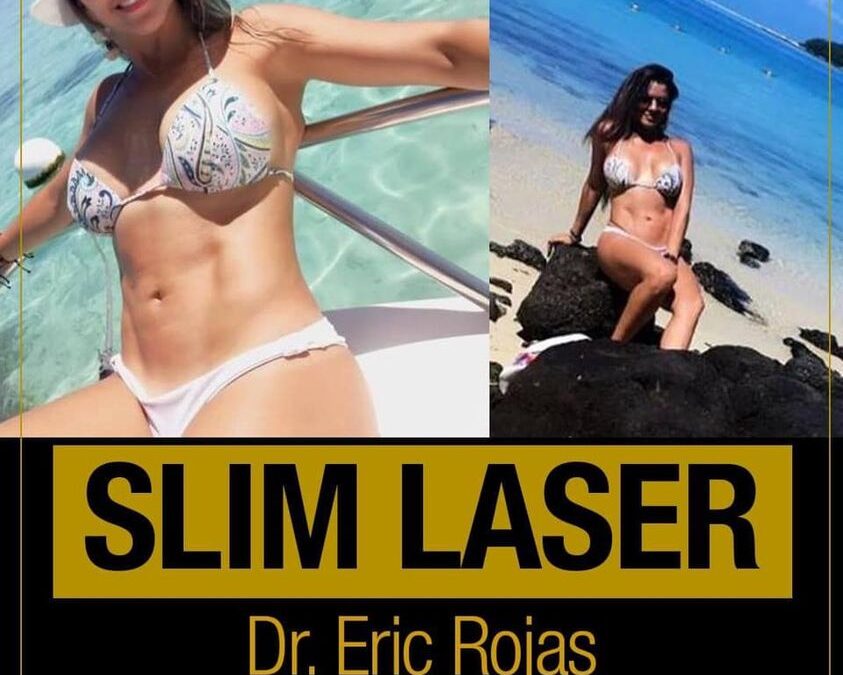 Vos también podés mejorar la apariencia de tu figura con SLIM LÁSER