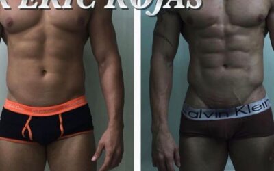 Slim laser en hombres