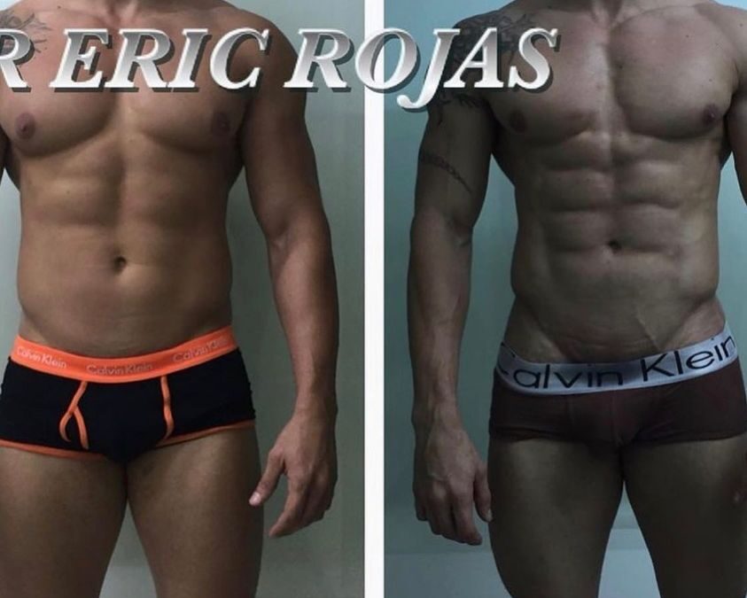 Slim laser en hombres